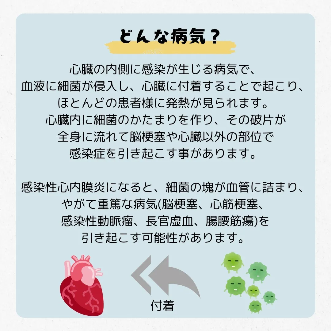 👨‍⚕️感染性心内膜炎の怖さ