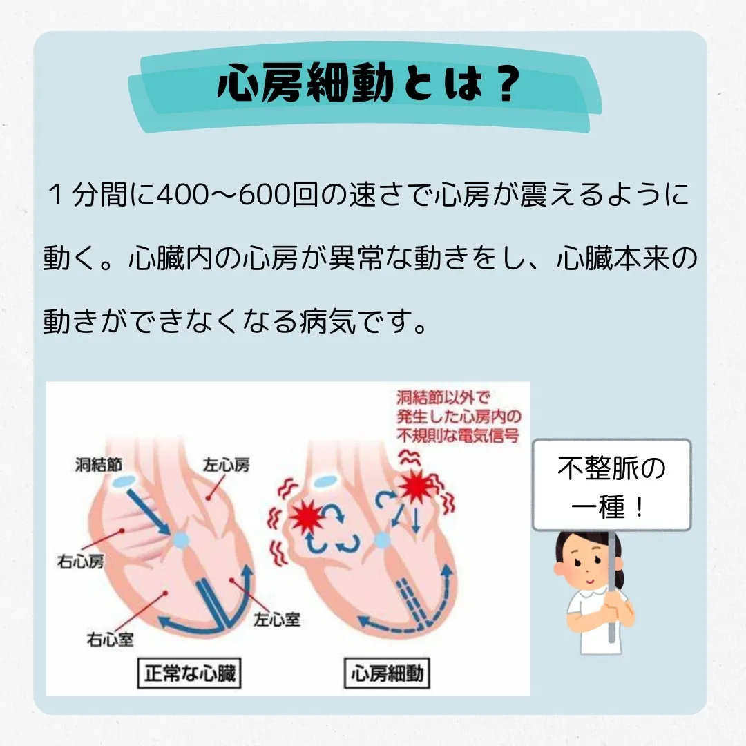 📌知っておきたい心房細動の知識